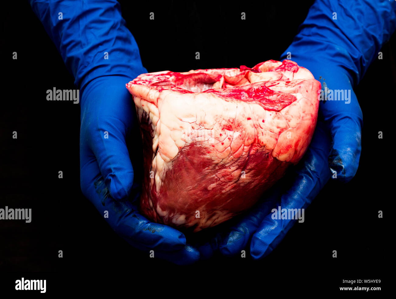 Herz in der Hand eines Chirurgen. illegale Organtransplantation Konzept. Tod und Geld Idee Stockfoto