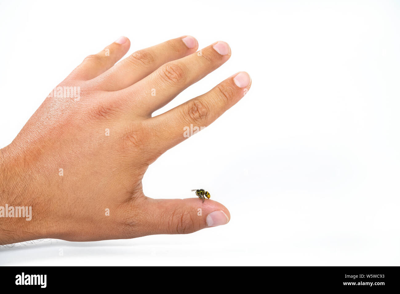 Nahaufnahme der Bienenstich mans Finger auf weißem Hintergrund. Wasp auf die Finger, die meisten Leute haben allergische Reaktion nach dem ist in der Regel s Stockfoto