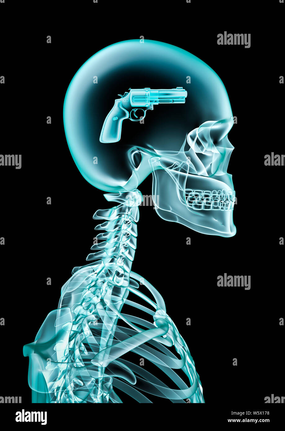 X-ray kriminellen Geist/3D-Abbildung des menschlichen Skeletts x-ray mit Pistole im Kopf Stockfoto