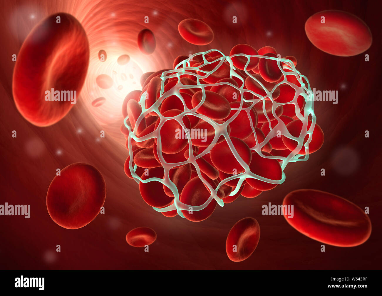 Medizinische Abbildung: ein Blutgerinnsel oder thrombus - Koagulation - 3D illustratio Stockfoto