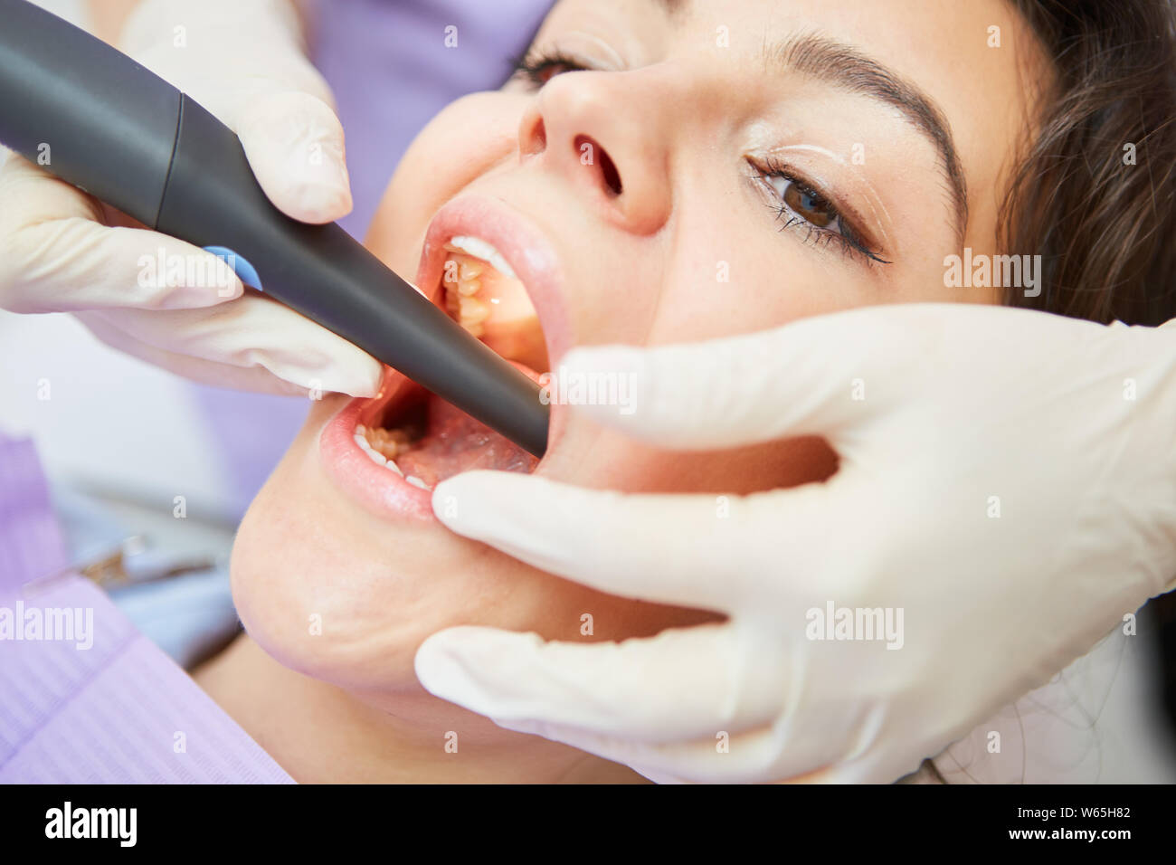 Zahnarzt bildet mit dem eine Wurzelbehandlung bei einem Patienten bohren Stockfoto