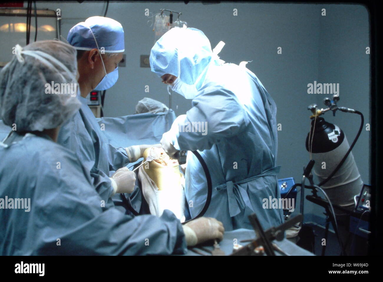 Orthopädische Chirurgen während der kniegelenkersatz Verfahren in einem örtlichen Krankenhaus in New Jersey 1985. Stockfoto