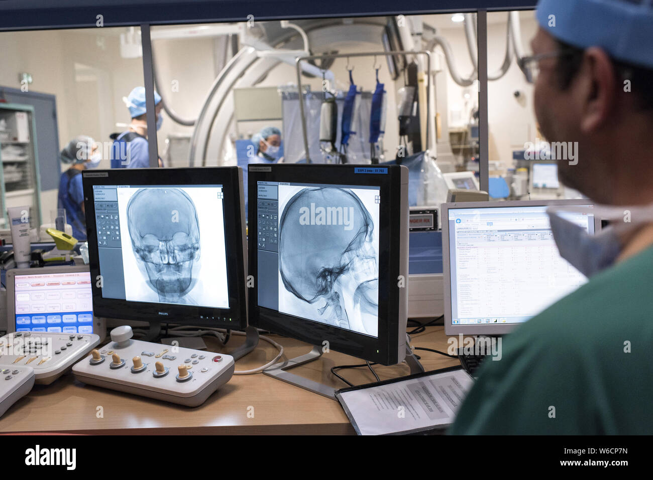 Clermont-Ferrand (Frankreich). Radiologie am Universitätsklinikum. Radiologe Durchführung einer Angiographie in der interventionellen Bildgebung ro Stockfoto