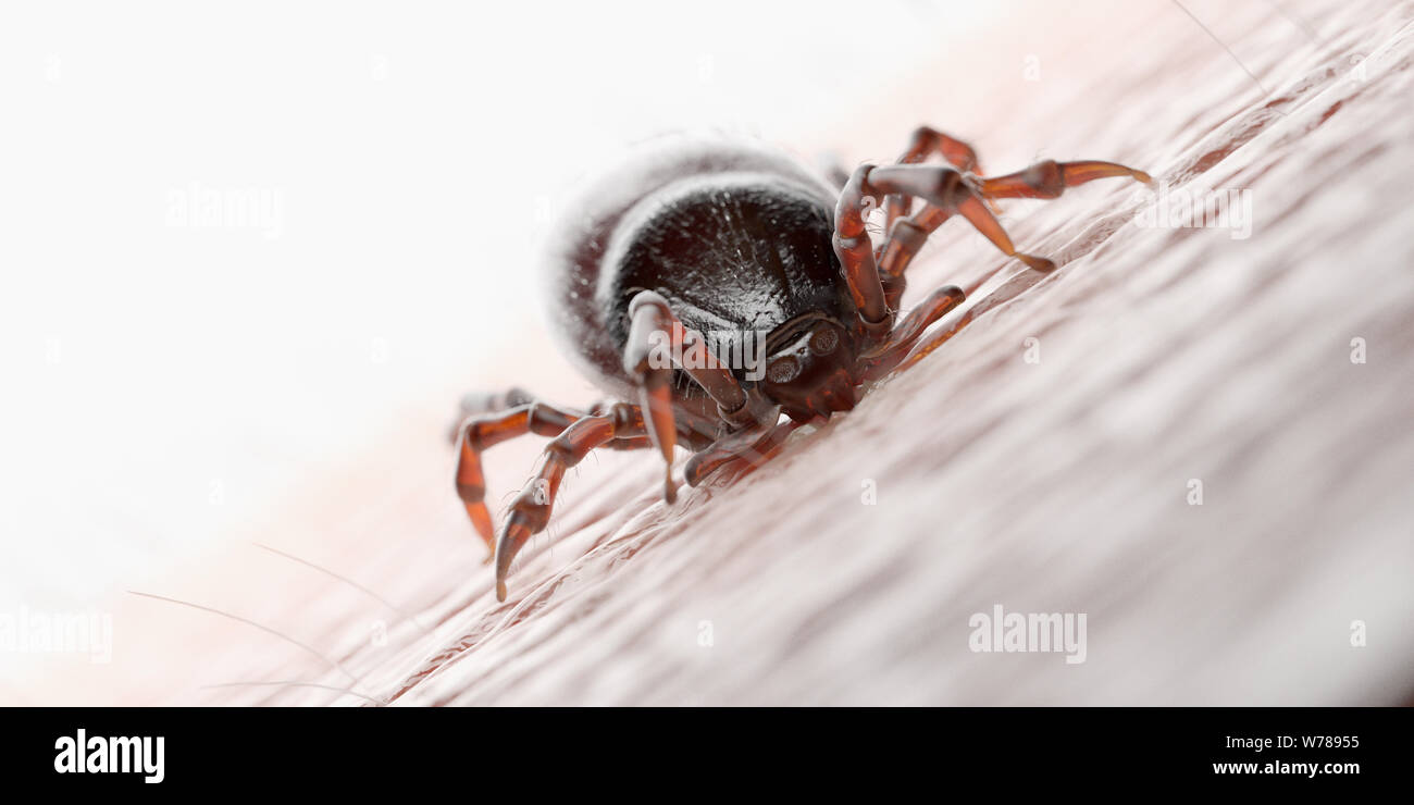 3D-gerenderte Abbildung: die Zecke in die menschliche Haut beißen Stockfoto