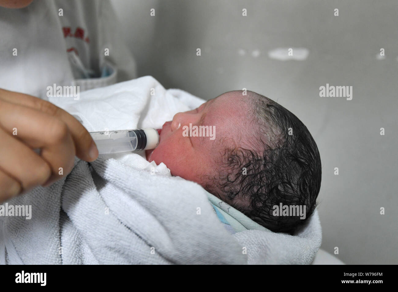 Das gesunde Mädchen baby Born durch chinesische Frau Wei Chunlan per Kaiserschnitt, der gerade etwas mehr als drei Meter hoch mit zwergwuchs wird dargestellt, an einem Stockfoto
