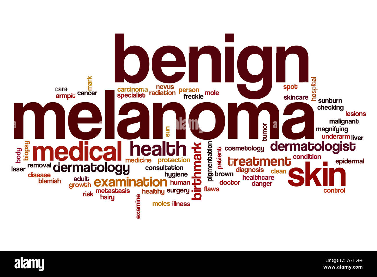 Gutartige Melanom Wort cloud Konzept Stockfoto
