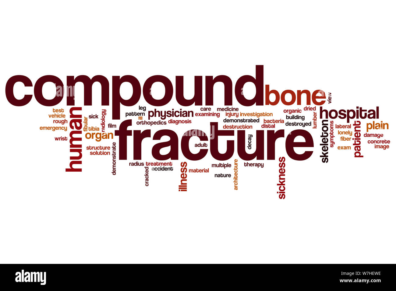 Compound Bruch Wort cloud Konzept Stockfoto