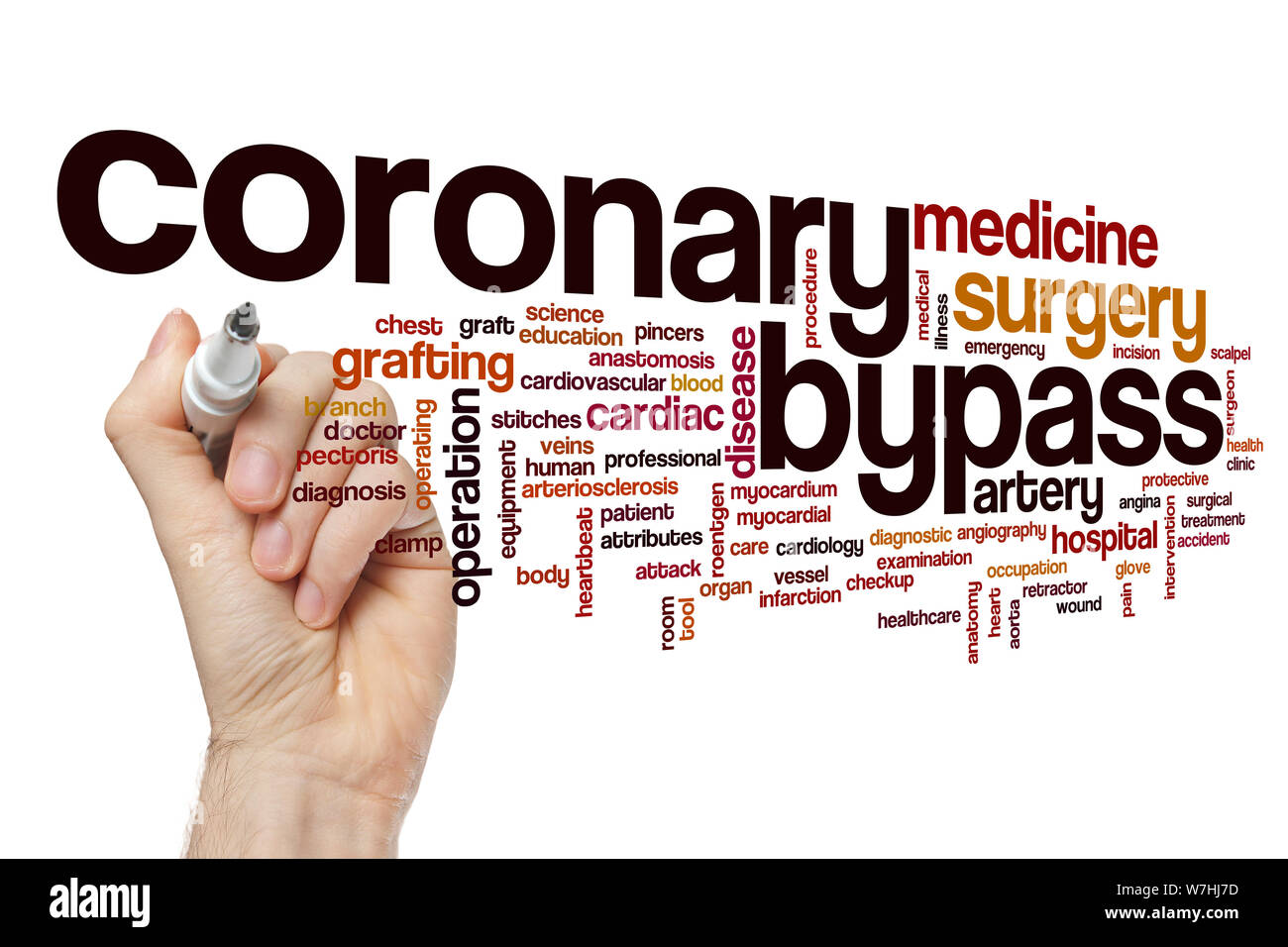 Bypass-operation Wort cloud Konzept Stockfoto
