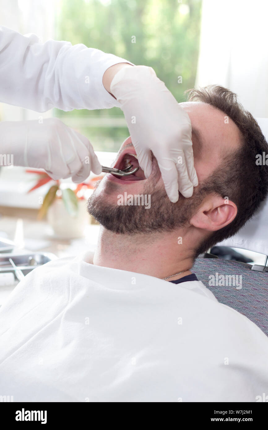 Weißer Mann sitzt auf einem Behandlungsstuhl mit seinen Mund weit öffnen. Die Hände der Zahnarzt in weißen Handschuhen griff den Zahn mit Krallen. Stockfoto