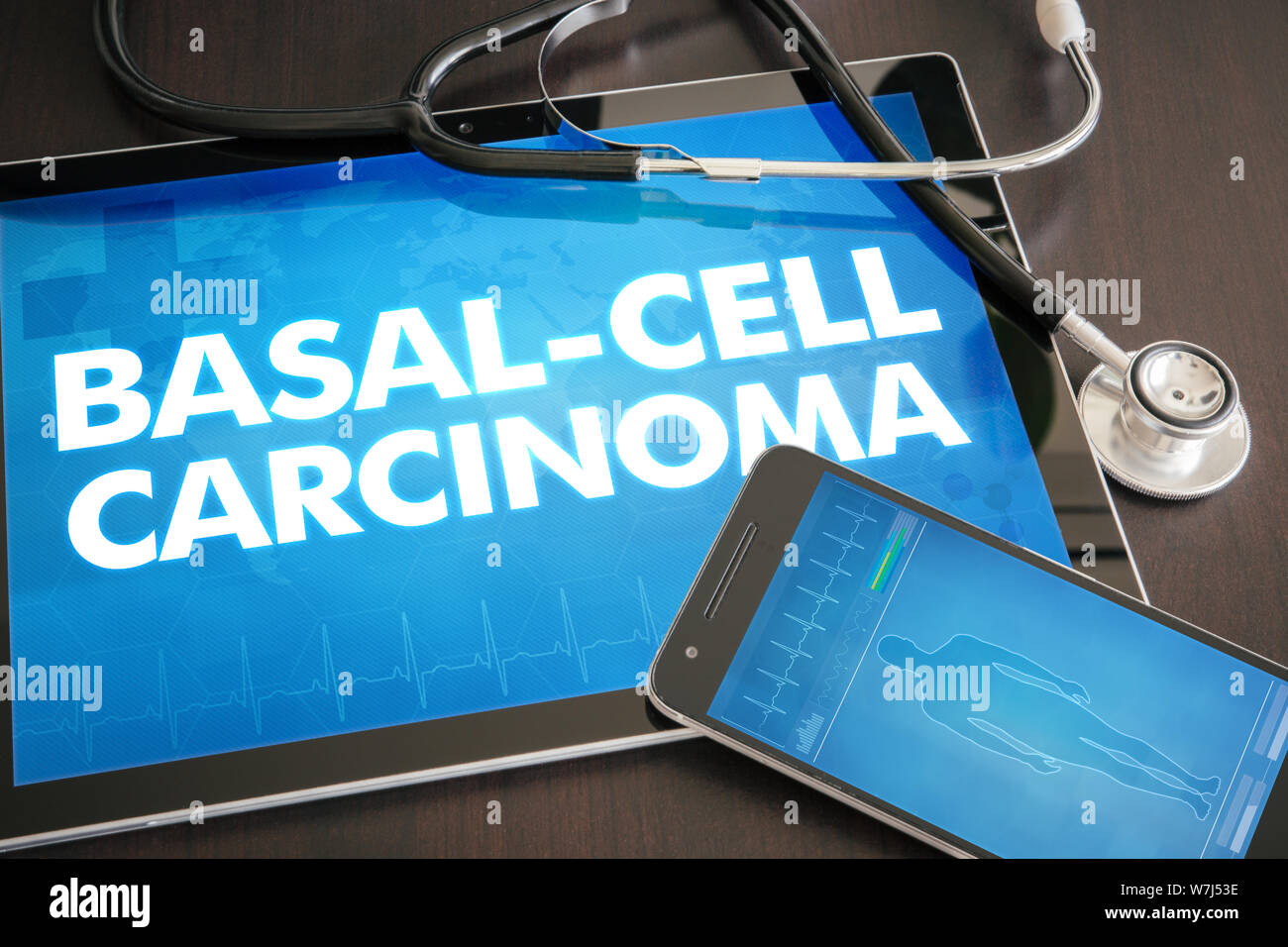 - Basal Cell Carcinoma (Krebs) Diagnose medizinisches Konzept auf Tablet Bildschirm mit Stethoskop. Stockfoto