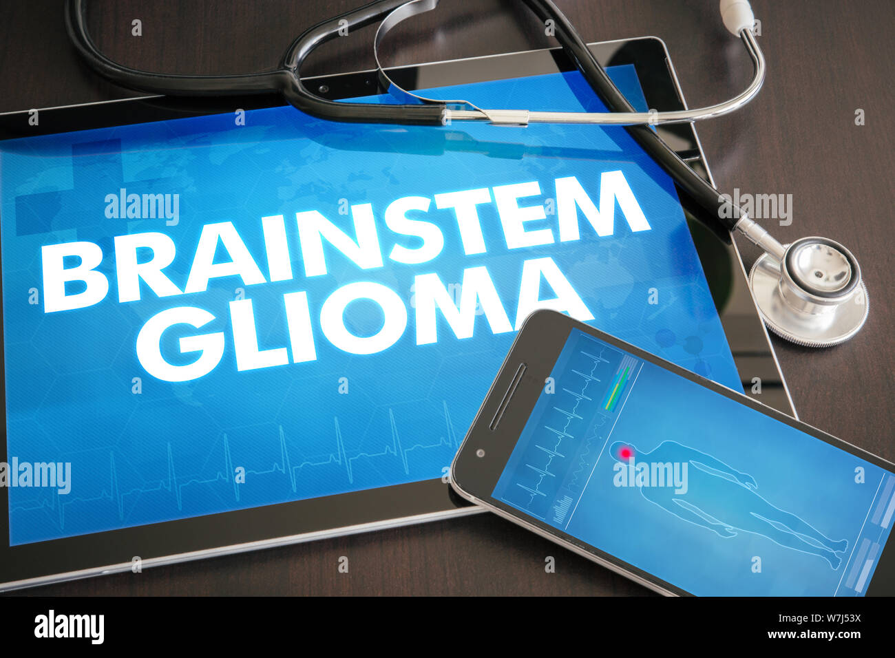 Hirnstamm Gliom (Typ) Diagnose medizinisches Konzept auf Tablet Bildschirm mit Stethoskop. Stockfoto