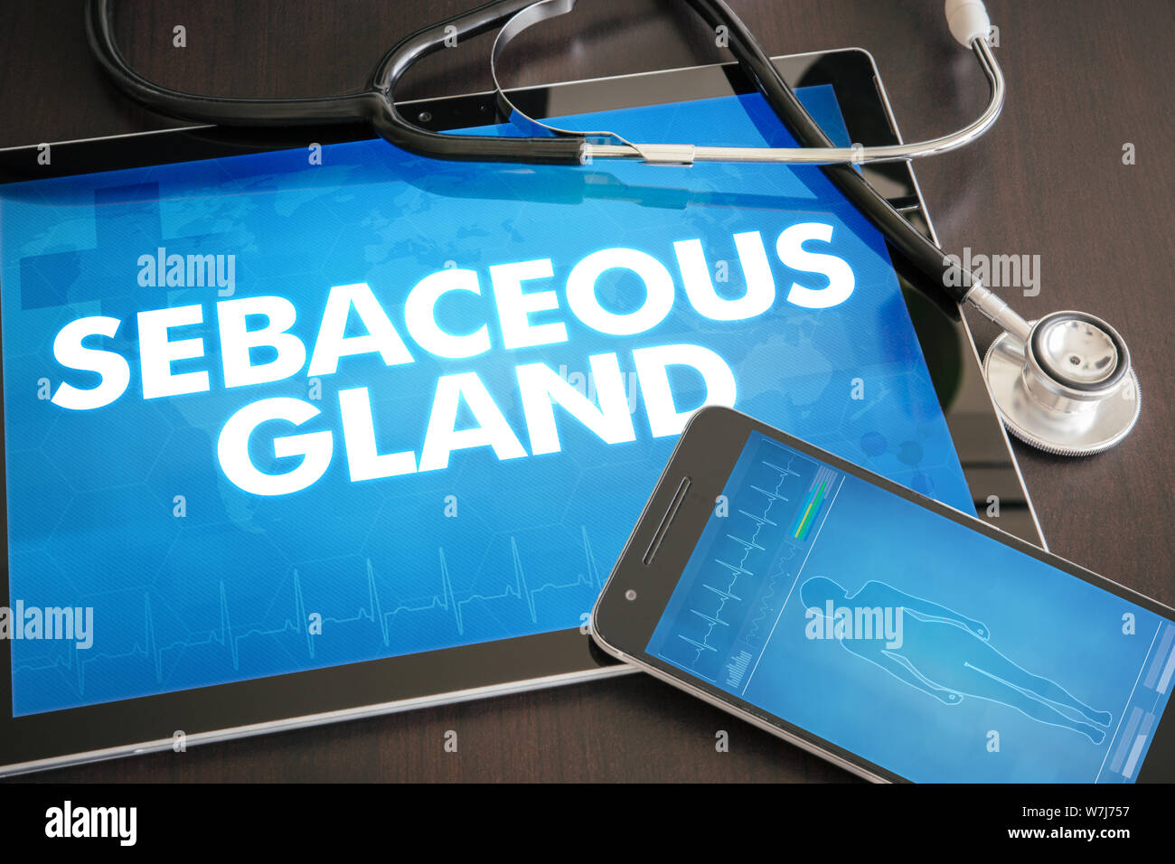Talgdrüse (kutane Krankheit bezogen) Diagnose medizinisches Konzept auf Tablet Bildschirm mit Stethoskop. Stockfoto