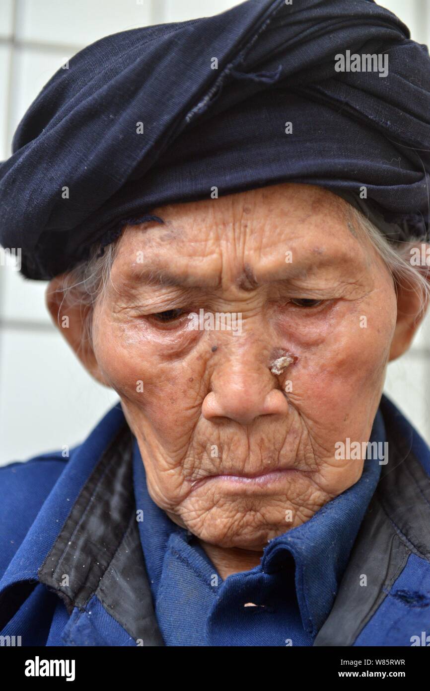 Fu Suqing Die Alteste Frau Der Welt Wurde Dargestellt Ist Zu Hause In Shuangliu County Chengdu City Im Sudwesten Chinas Provinz Sichuan 14 Jul Stockfotografie Alamy