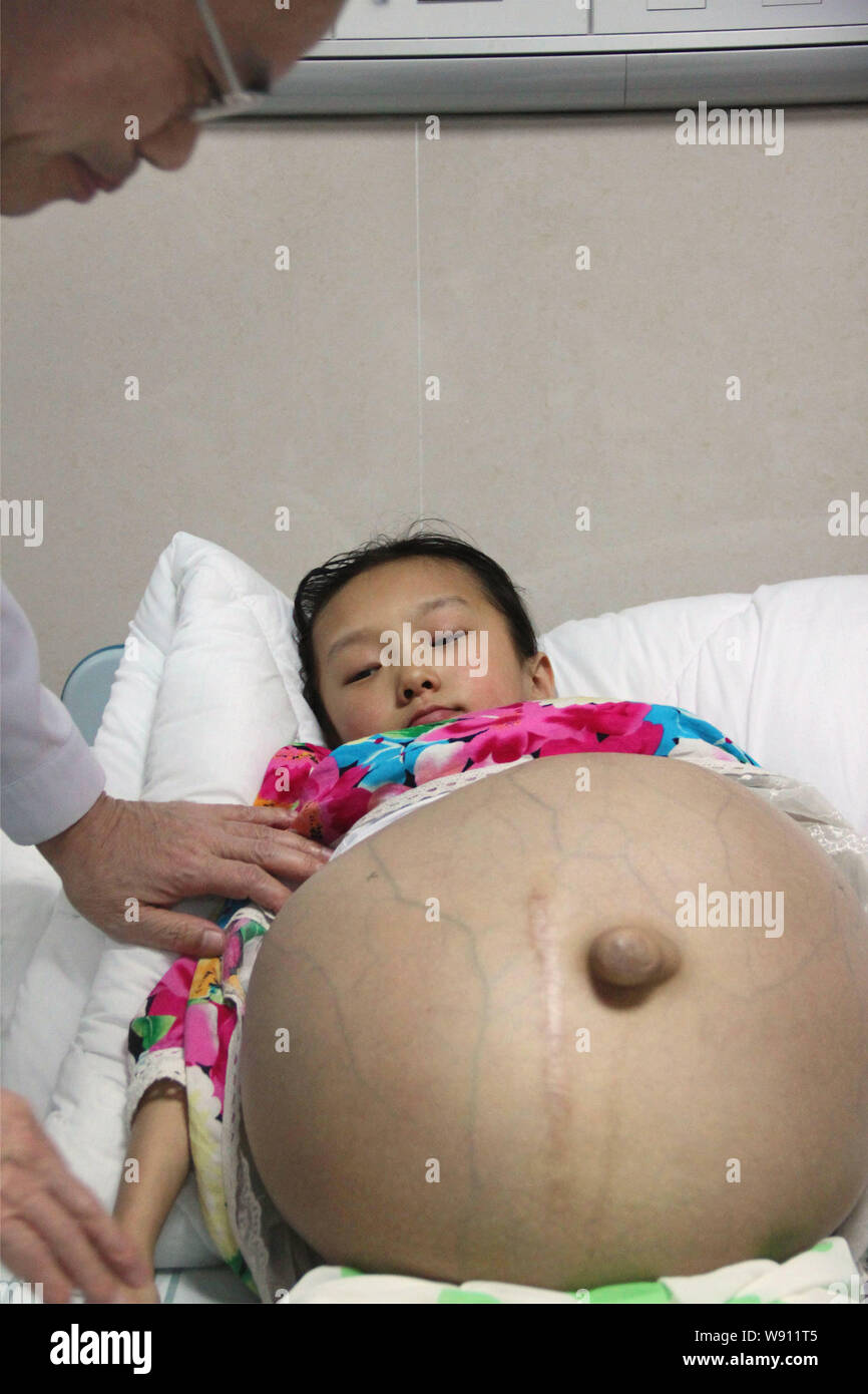 der arzt untersucht die 12 jahrige han bingbing die aus einem riesigen tumor im bauch an fuda krebs krankenhaus in guangzhou stadt leidet south china gu stockfotografie alamy