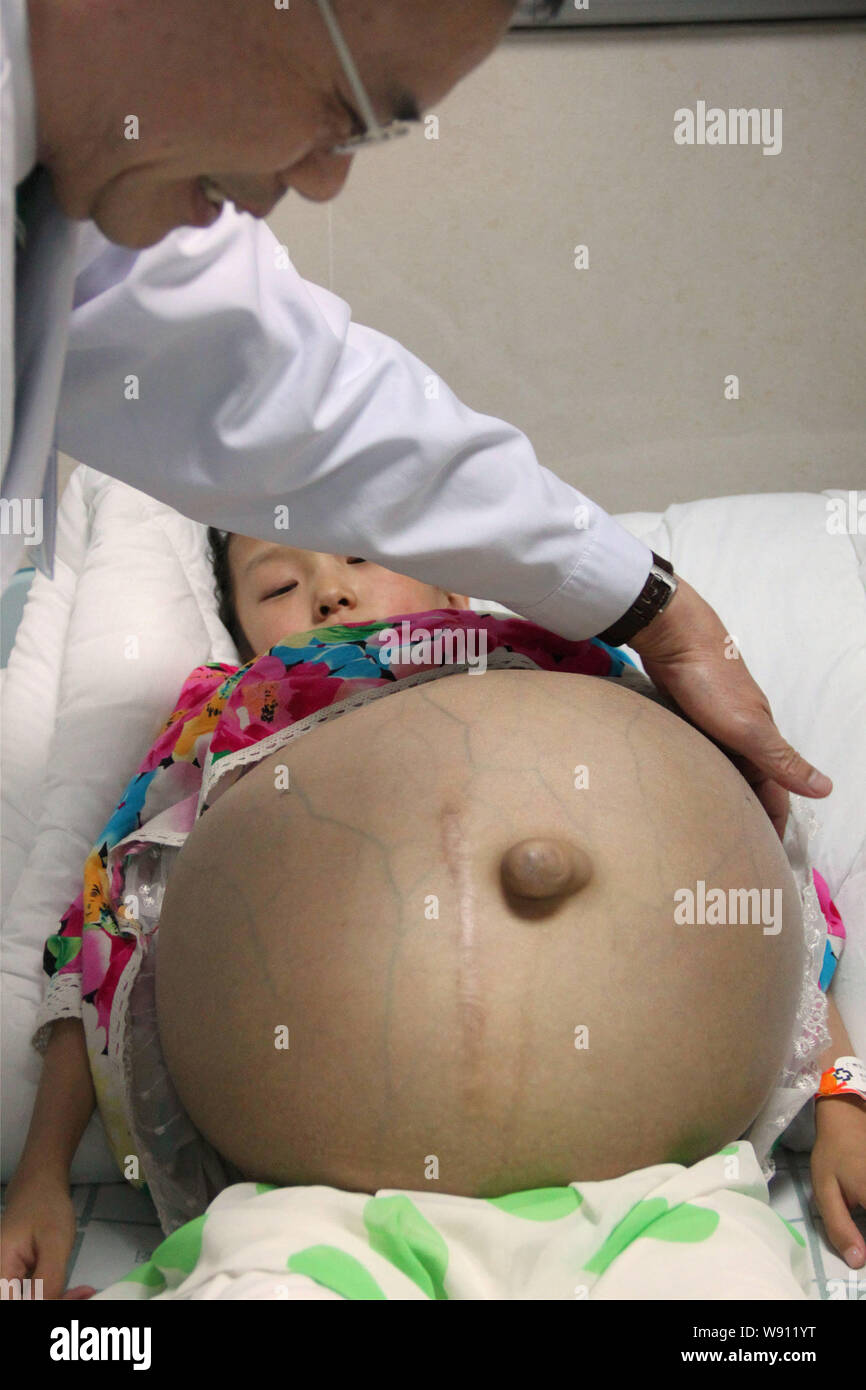 der arzt untersucht die 12 jahrige han bingbing die aus einem riesigen tumor im bauch an fuda krebs krankenhaus in guangzhou stadt leidet south china gu stockfotografie alamy