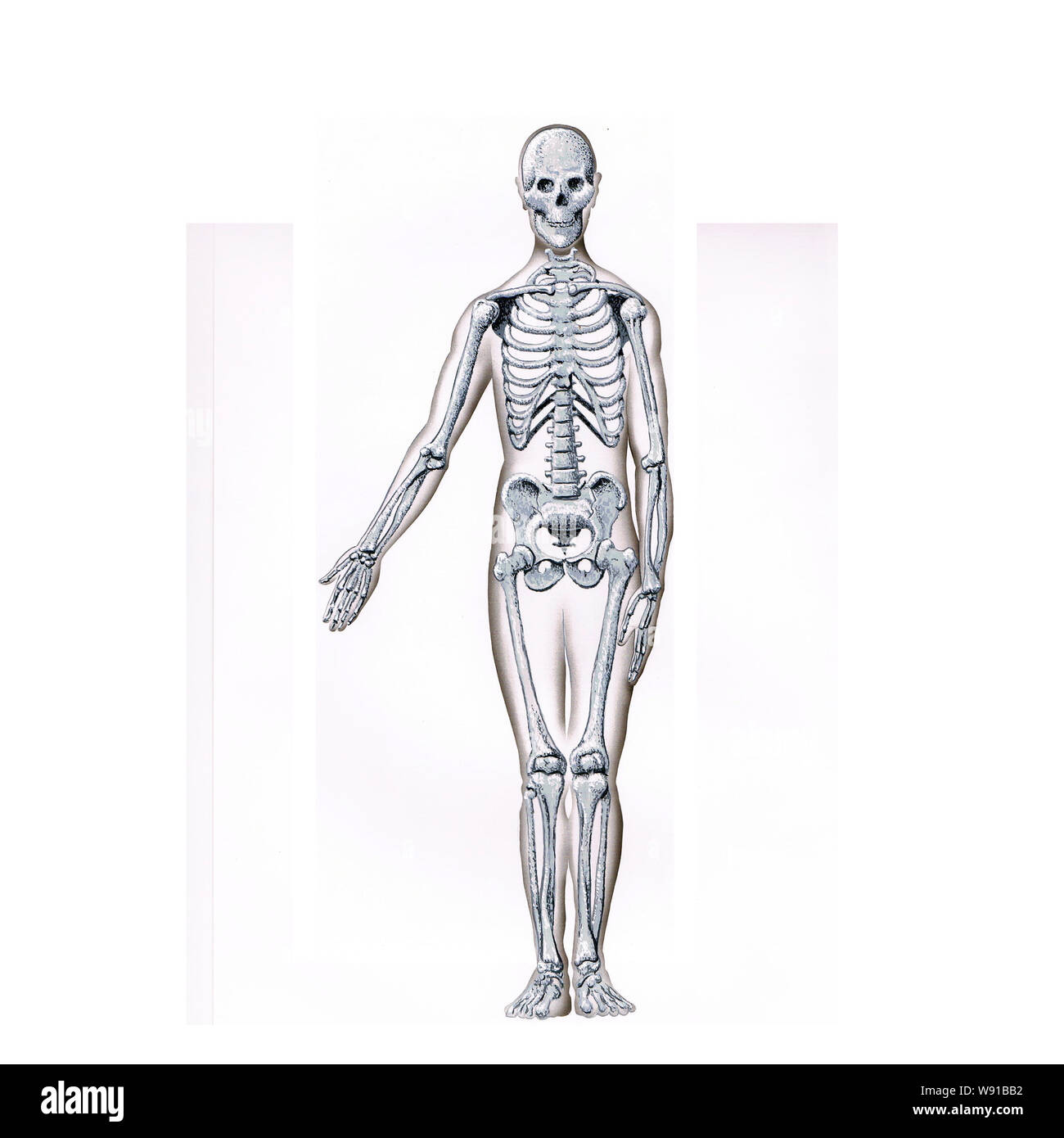 Skelett pensil Skizze mit einem Arm stellte sich heraus, dass der andere Arm durch seine Seite mit einer Haut Fleisch Umrisse um ihn herum Stockfoto