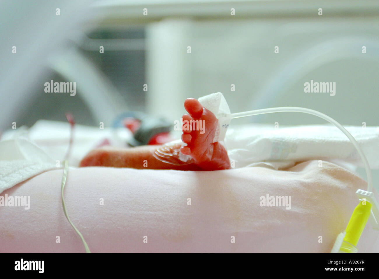 Die vorzeitige weiblichen Säugling erhält die medizinische Behandlung in einem Inkubator in ICU am Xiangya Krankenhaus in Changsha City, Central China Hunan Provinz, Stockfoto