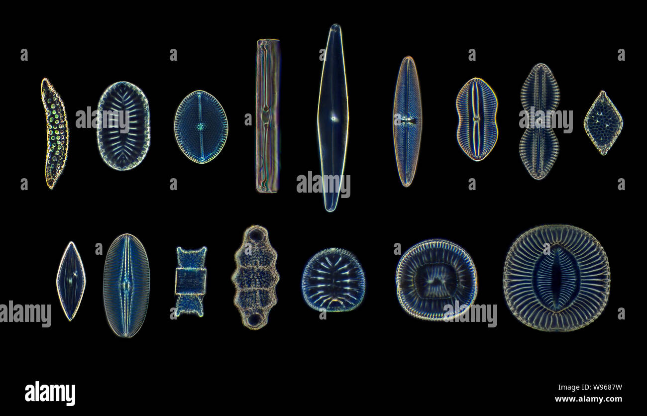 Vielfältige Auswahl an kieselalge Arten, Dunkelfeld photomicrograph Stockfoto