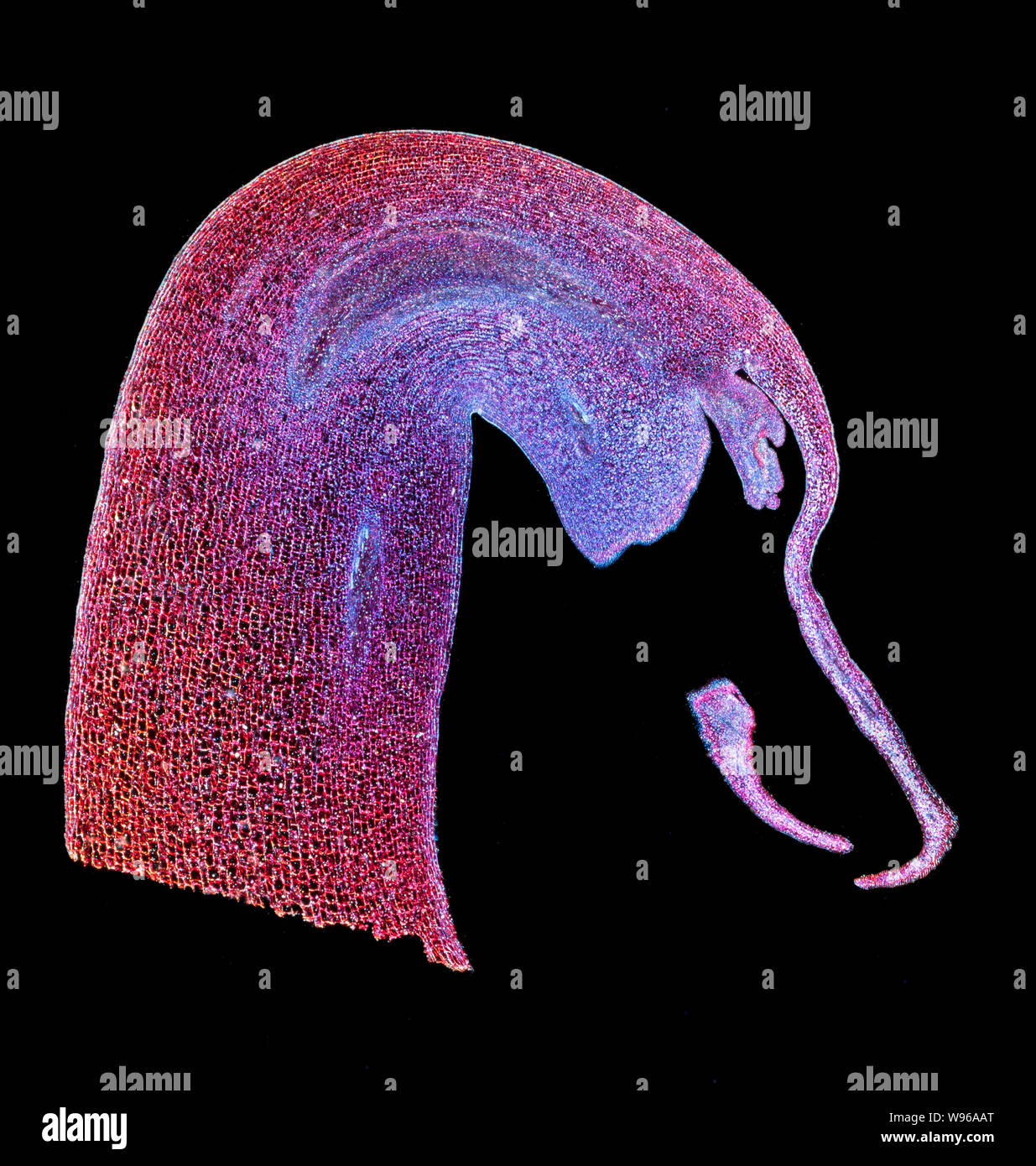 Bohne, Vicia faba, Detail der plumule LS, gebeizt. Darkfield photomicrograph Stockfoto