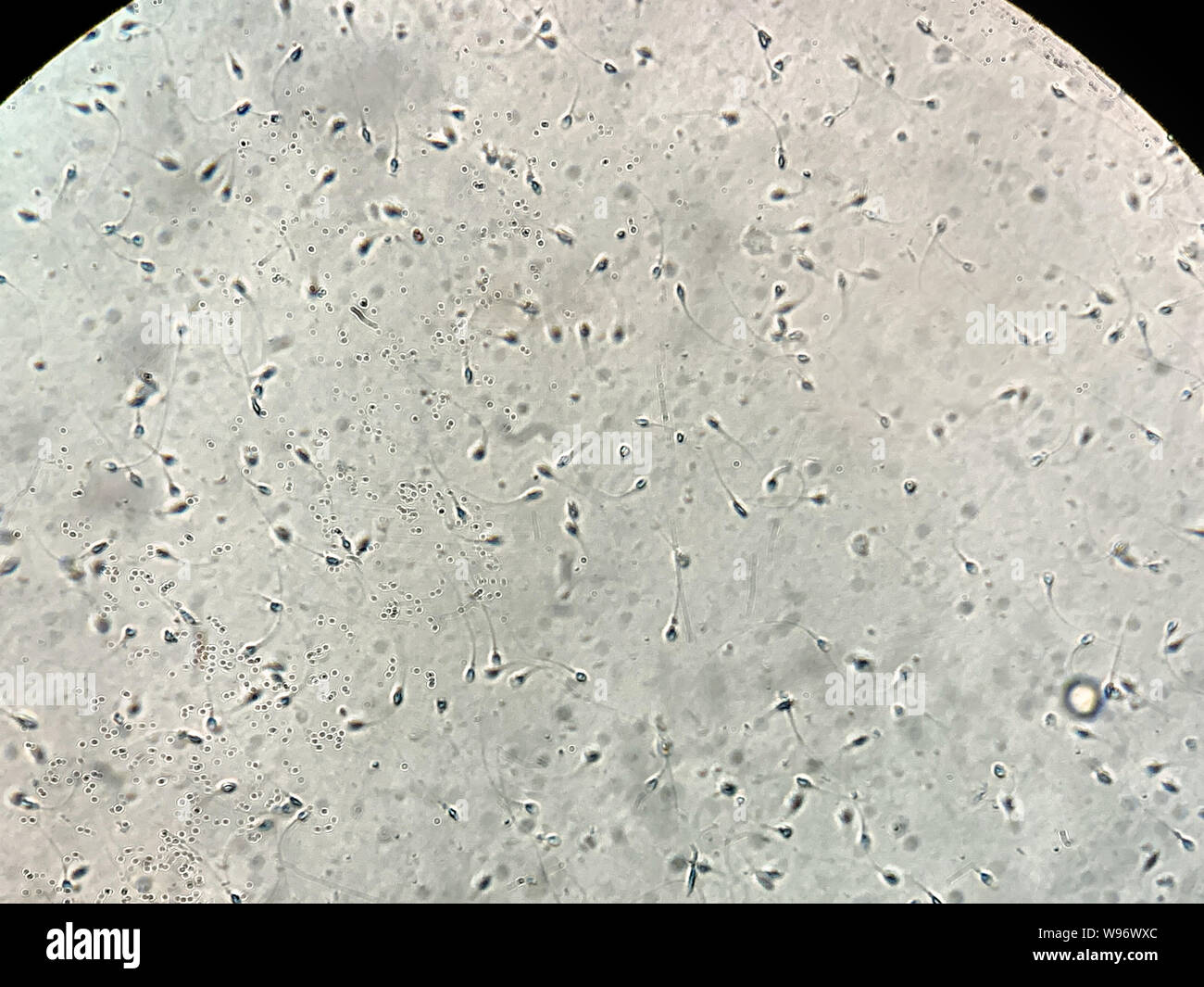 Blick auf menschliche Spermien im Labor unter dem Mikroskop Stockfotografie  - Alamy