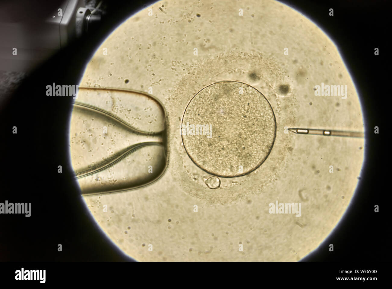 Blick durch Mikroskop bei In-vitro-Befruchtung Stockfoto