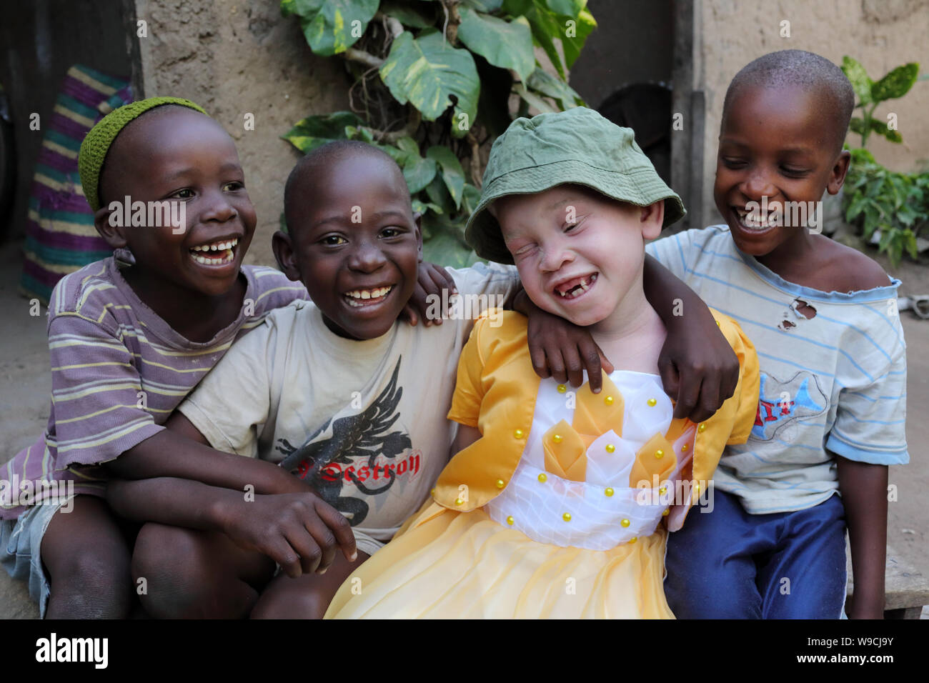 Albino Kind und Jungen in Ukerewe, Tansania. Viele traditionelle Heiler haben kürzlich in Tansania festgenommen worden, weil der Albino Morde Stockfoto