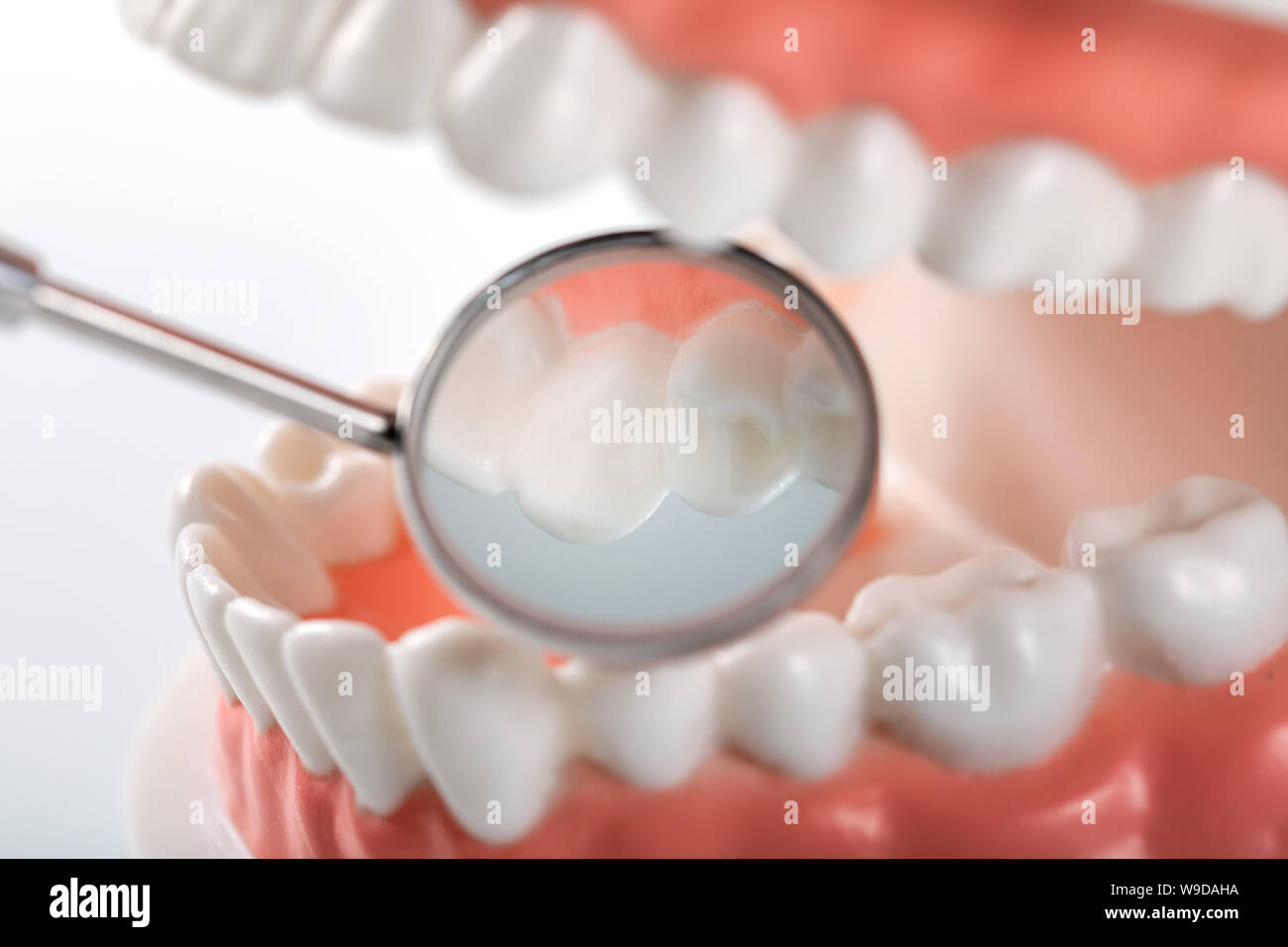 Mundhygiene: Detailansicht der zahnmedizinischen Spiegel an der Innenseite der Zähne Modell Stockfoto