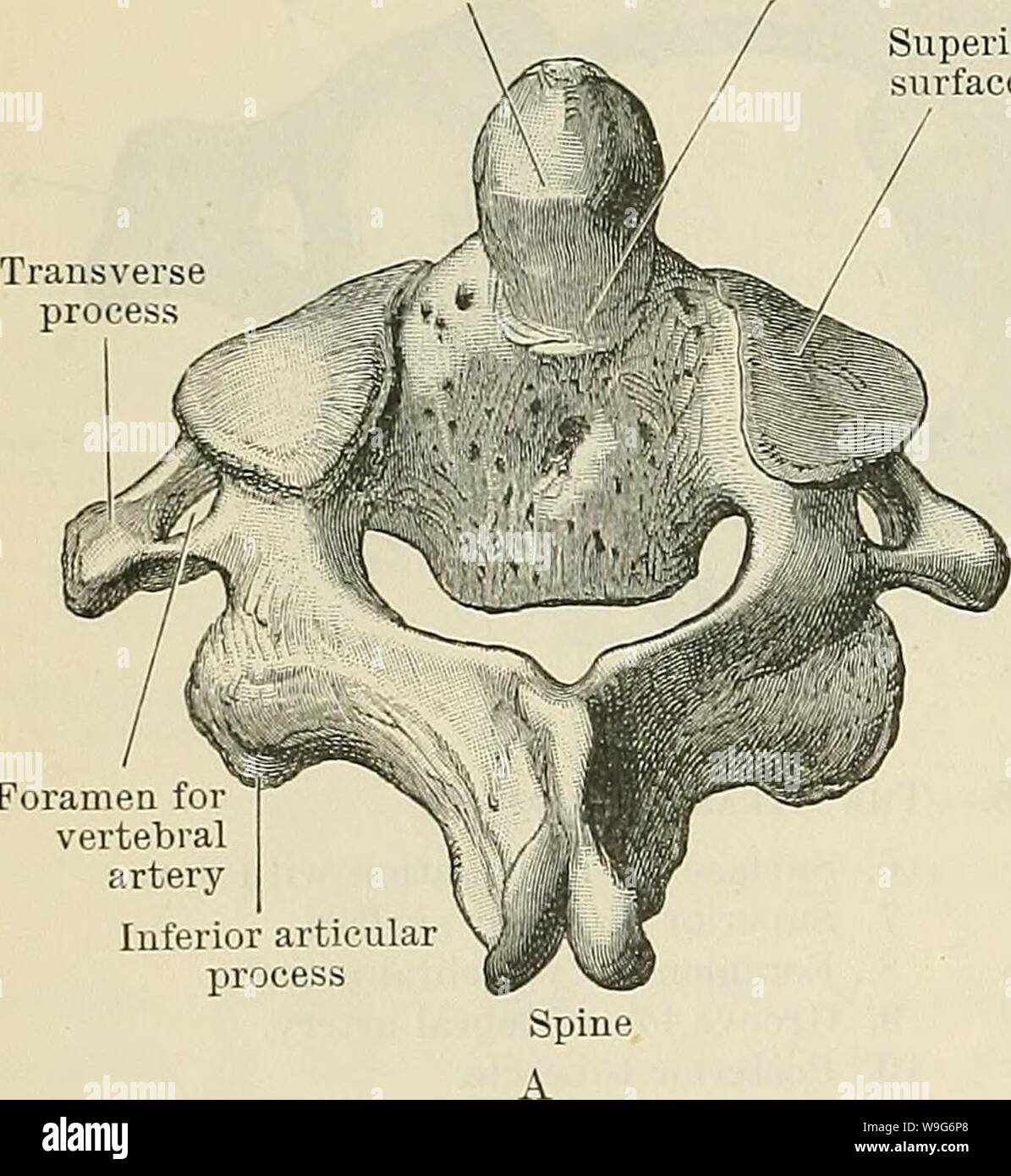 Archiv Bild ab Seite 125 von Cunningham's Lehrbuch der Anatomie (1914). Cunninghams Lehrbuch der Anatomie cunninghamstextb 00 cunn Jahr: 1914 (92 OSTEOLOGIE. Häufig wird entwickelt, bilden eine Brücke von Knochen auf, die Umwandlung der Nut in einen Kanal, durch den der A. vertebralis und der Ramus posterior des suboccipital Nerv Pass - ein Zustand, der normalerweise bei in vielen Tieren. Es ist bemerkenswert, dass die Nuten der beiden höchsten Spinalnerven Verfahren hinter die Gelenkfortsätze liegen, an Stelle von vorne, wie in anderen Teilen der Spalte. Den Ring durch die seitlichen gebildet Stockfoto