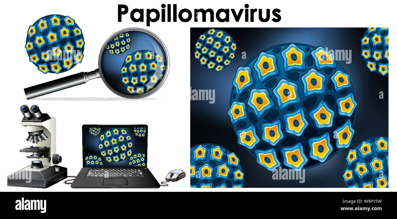 Papillomavirus Virus auf dem Computer Bildschirm und Lupe Abbildung Stock Vektor