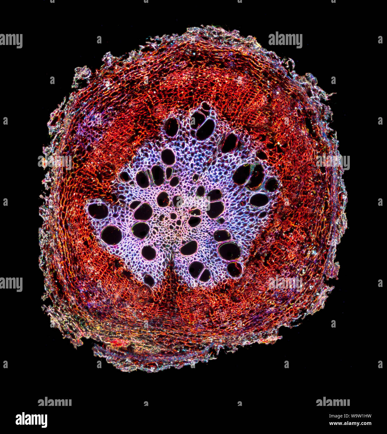 Sonnenblume Stammzellen TS. Helianthus sp. Darkfield photomicrograph Stockfoto