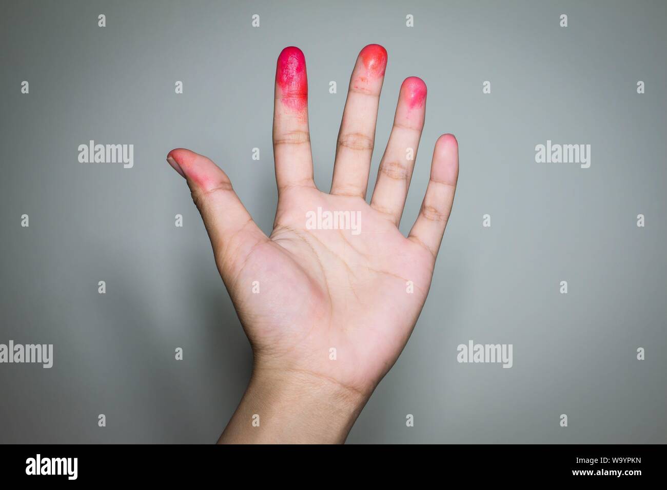 Blutige an den Fingern ein Zombie in einem Halloween Festival. Stockfoto
