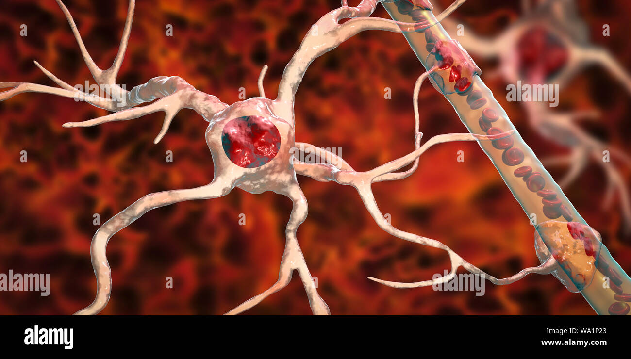 Astrocyte und Blutgefäßen, computer Abbildung. Astrozyten und Gliazellen des Gehirns, auch als astroglia bekannt, neuronale Zellen Blutgefäße anschließen und die Blut-Hirn-Schranke. Stockfoto