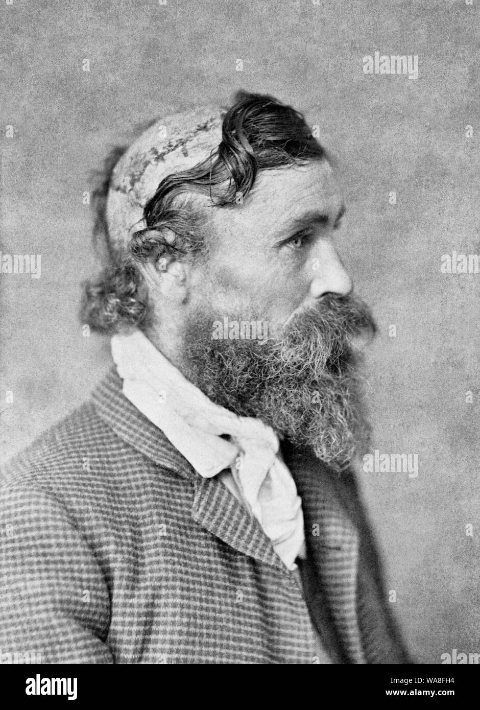 Robert McGee, skalpiert von Sioux Chief kleine Schildkröte im Jahr 1864. Robert McGee, Kopf und Schultern hoch, nach rechts, folgen der Skalpiert zu werden wie ein Kind. 1890 Stockfoto