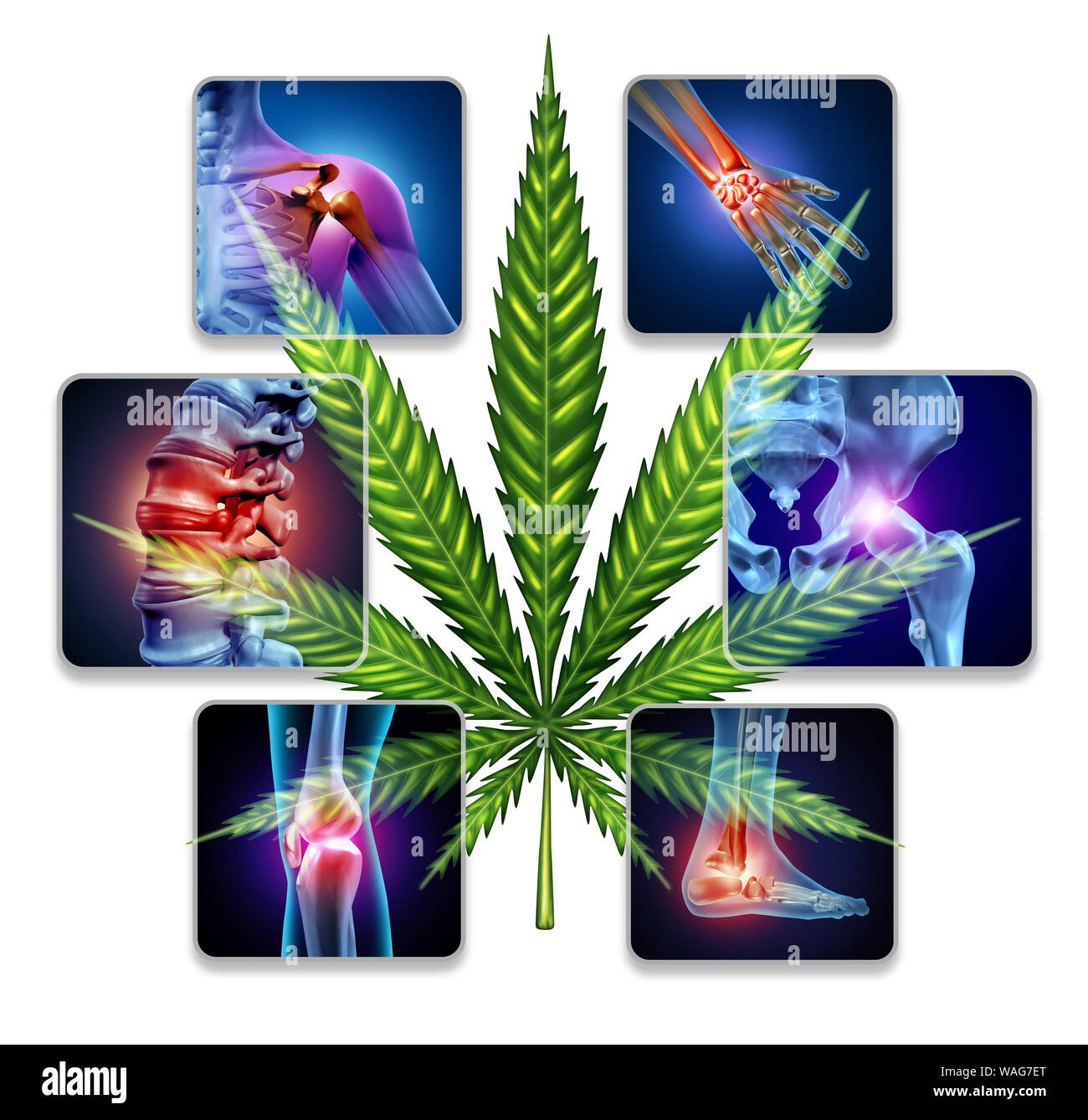 Cannabis für die Behandlung von Gelenkschmerzen und medizinisches Marihuana als Medizin als natürliche Arzneimittel zur Behandlung von schmerzhaften chronischen Krankheit zu heilen. Stockfoto