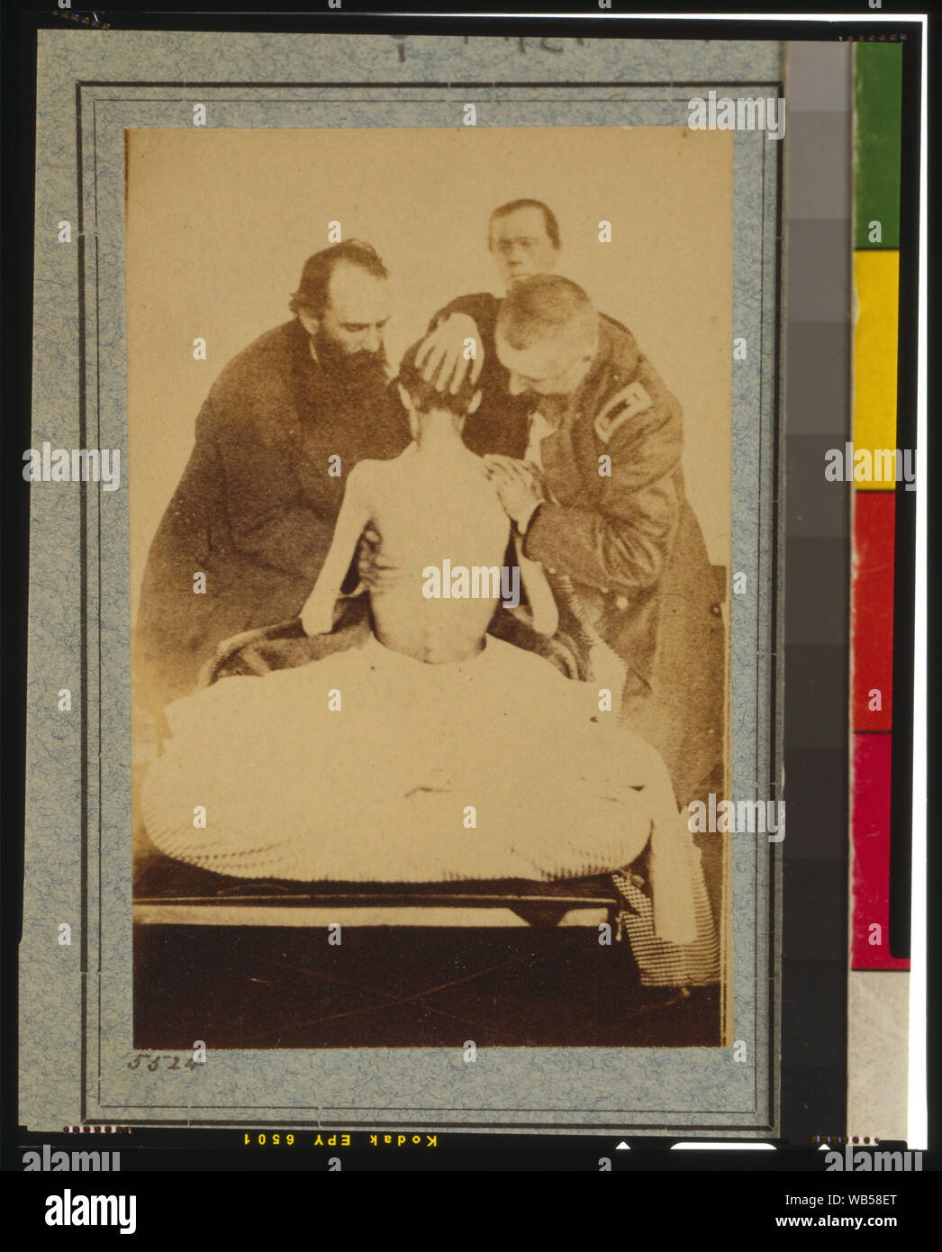 Abgemagert Kriegsgefangenen von Belle Isle, Richmond, Private Jesaja G. Bowker von Co.B, 9th Maine Freiwillige, auf den US-General Hospital, Div. 1, Annapolis Abstract: Foto zeigt Pvt. Jesaja G. Bowker (d. 1864), Co. B, 9 Bde. Maine an der US-General Hospital Div.Nr. 1, Annapolis, Maryland. Quelle: U.S. Army Erbe und Education Centre, 2013. Stockfoto