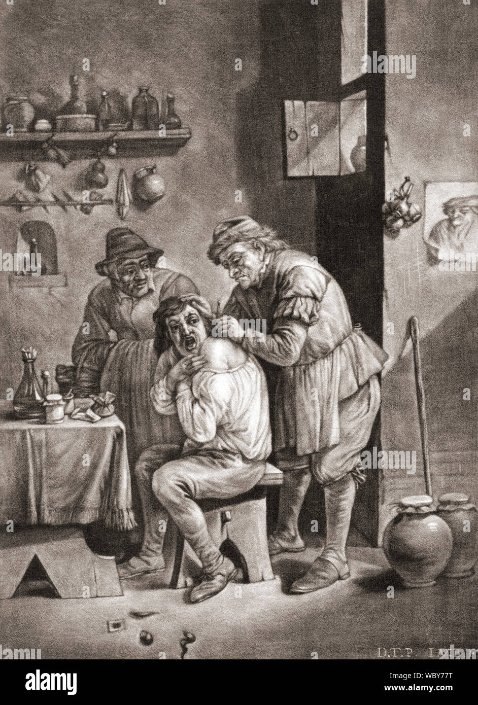 Ein Chirurg führt Operation auf der Schulter des Mannes im 18. Jahrhundert. Nach einem 18. Jahrhundert arbeiten. Stockfoto Ein Chirurg führt Operation auf der Schulter des Mannes im 18. Jahrhundert. Nach einem 18. Jahrhundert arbeiten. Stockfoto