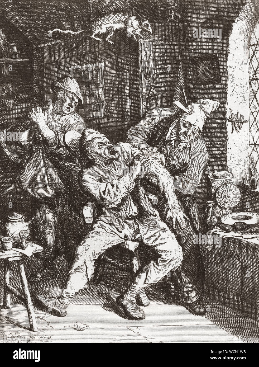 Im 17. Jahrhundert, ein Chirurg führt eine Operation am Arm eines Mannes, während eine verzweifelte Frau Uhren. Nach einem 17. Jahrhundert arbeiten. Stockfoto
