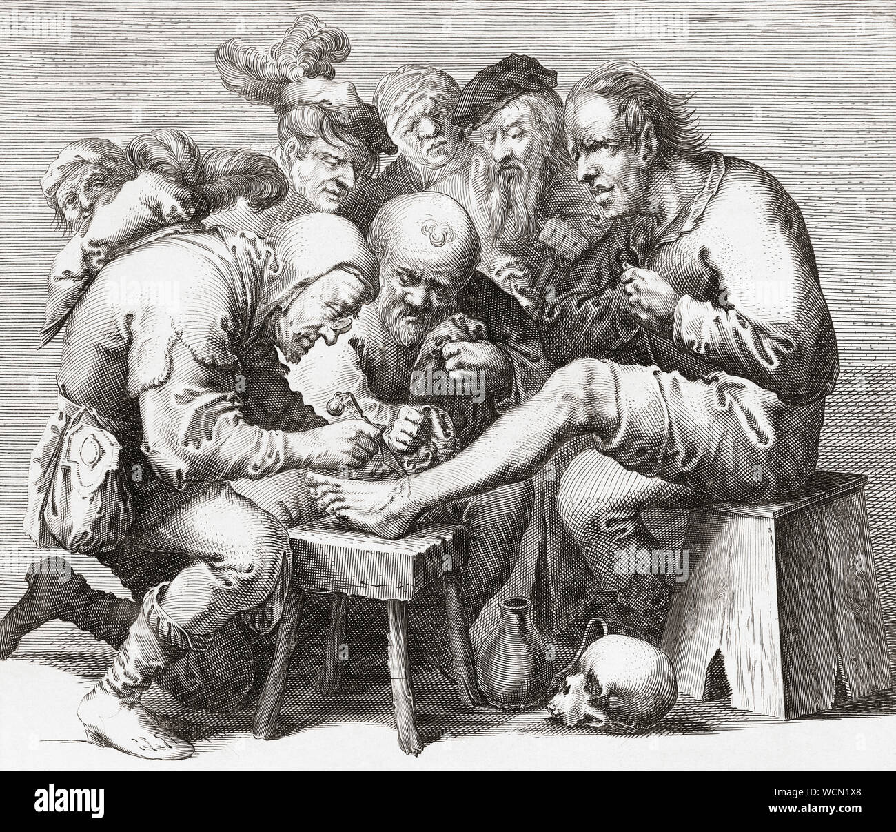 Im 17. Jahrhundert, ein Chirurg führt Chirurgie auf dem Fuß. Nach einem 17. Jahrhundert arbeiten. Stockfoto