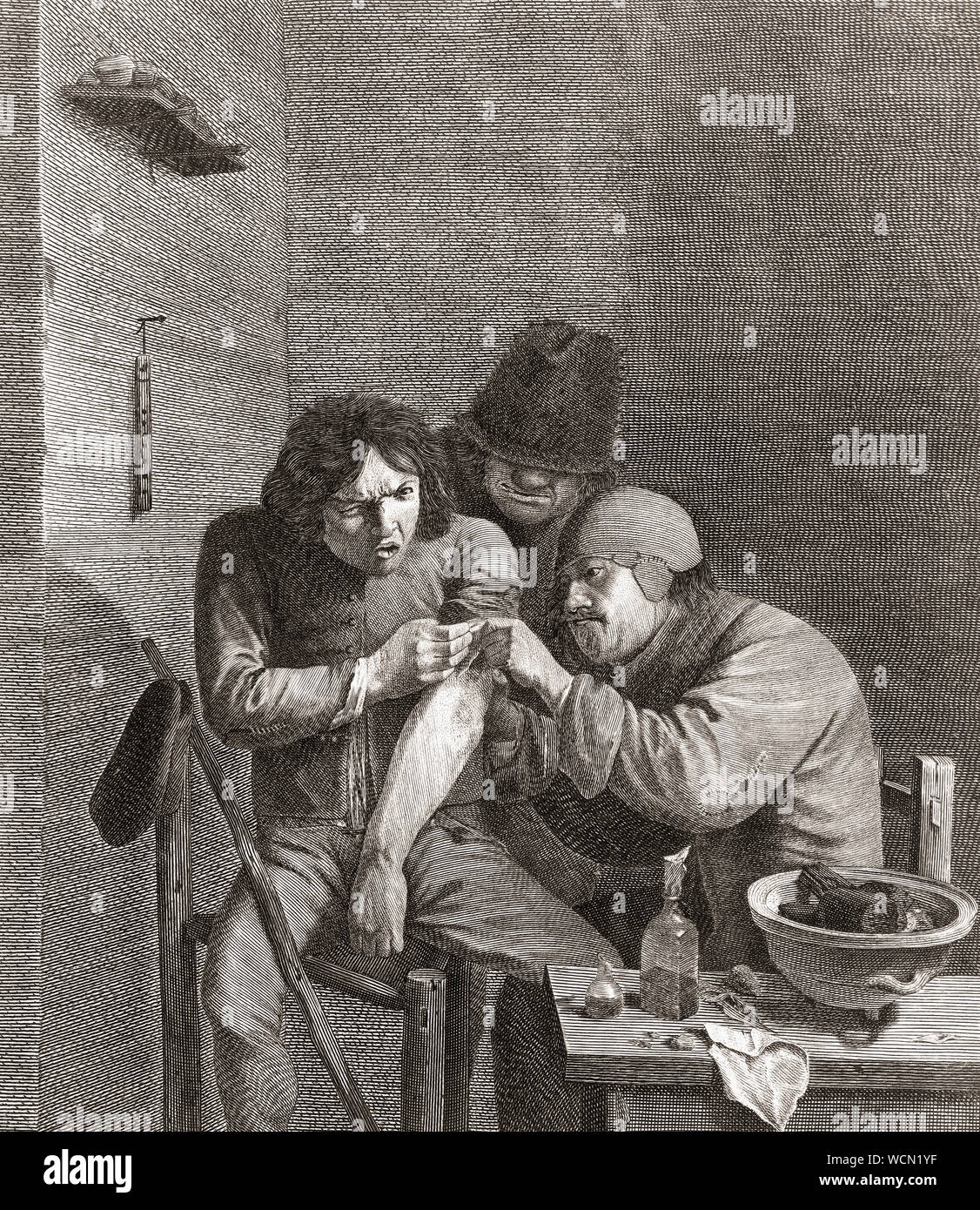 Ein Chirurg operiert auf dem Arm des Patienten im 17. Jahrhundert. Nach einem späteren Kopie des 17. Jahrhunderts arbeiten von Marinus Robyn van der geht. Stockfoto