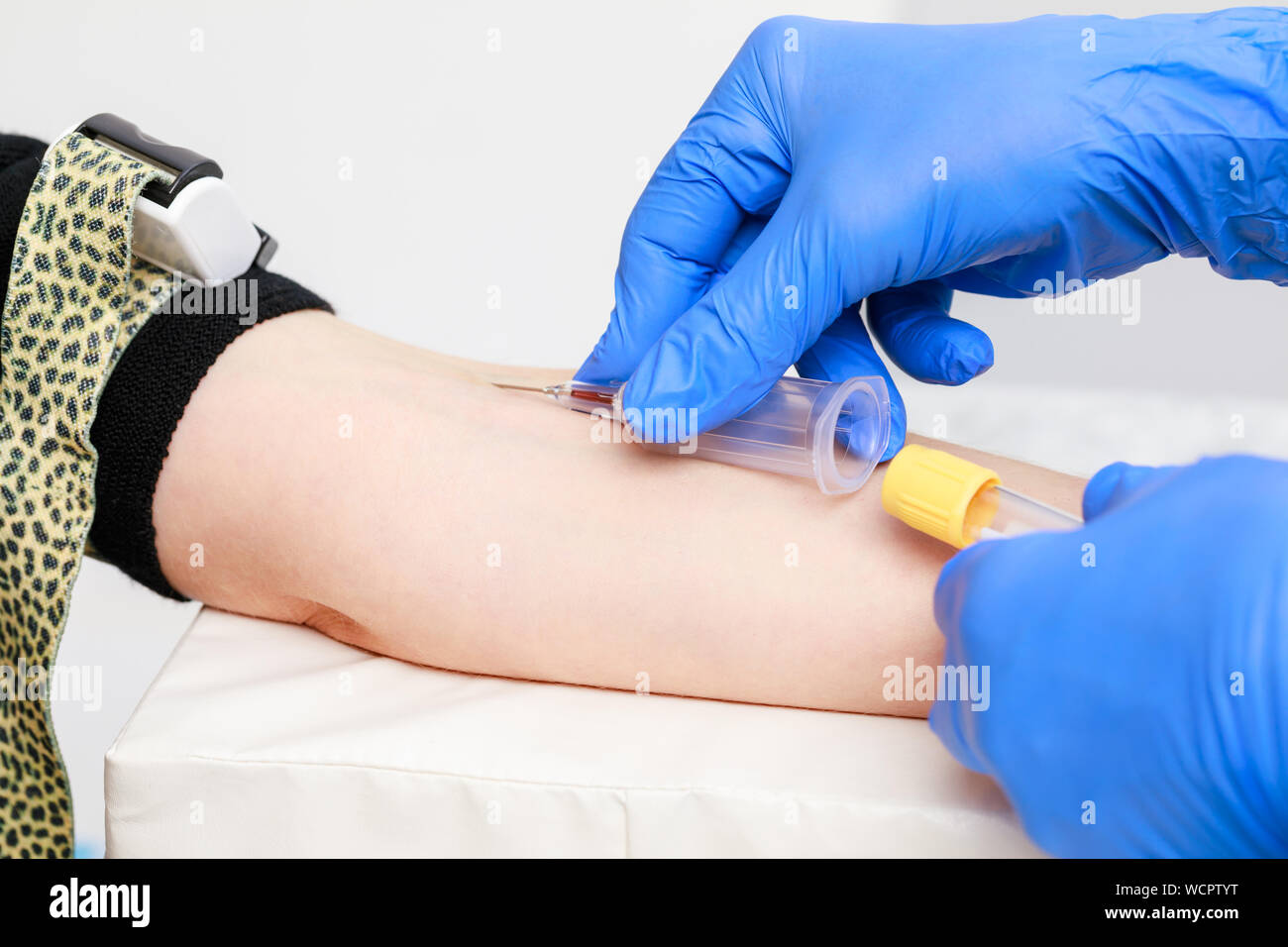 Nahaufnahme der Arzt oder die Krankenschwester durch Entnahme einer Blutprobe aus der Armvene mit einem vacutainer. Die blutentnahme oder blutentnahme Verfahren Stockfoto