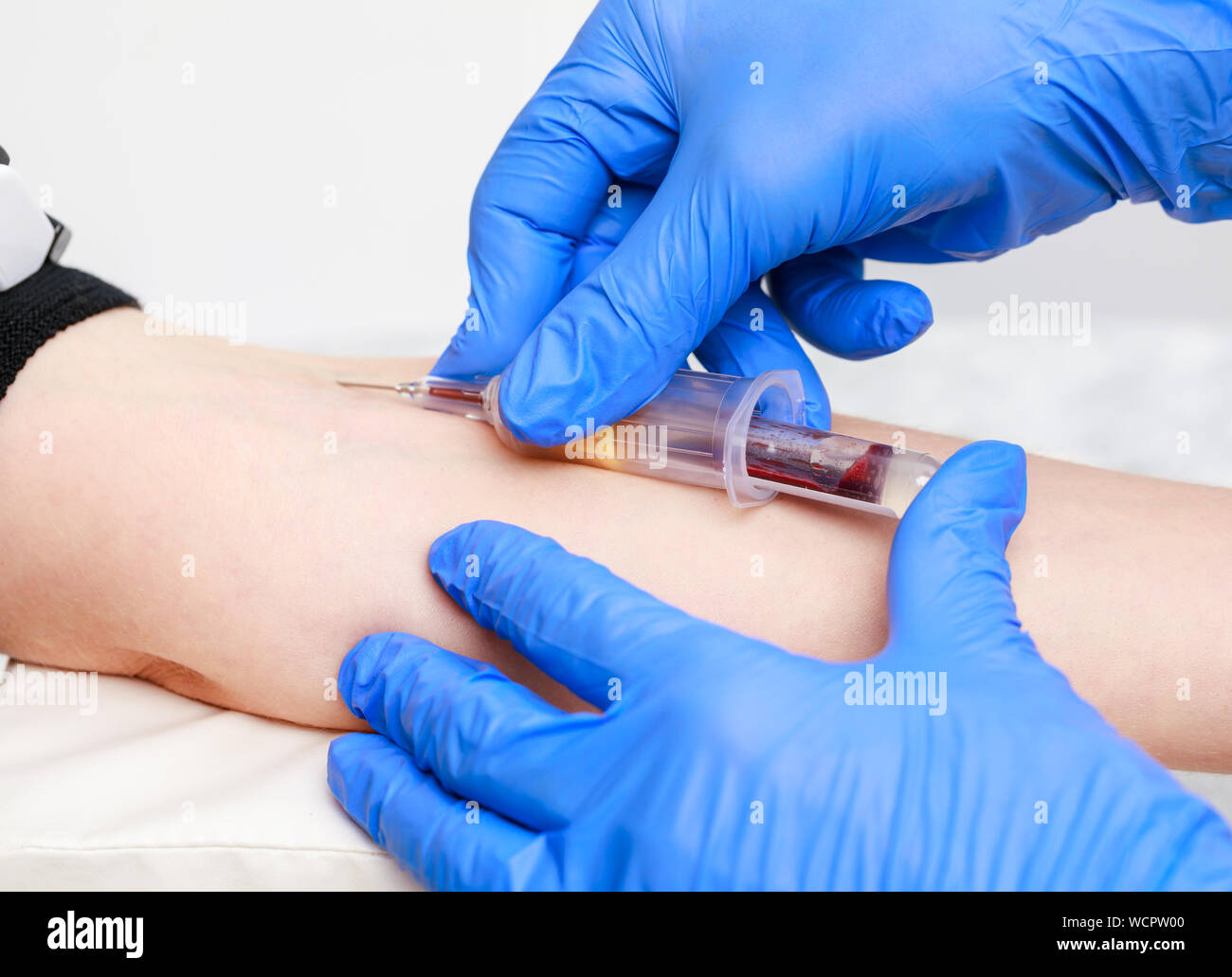 Nahaufnahme der Arzt oder die Krankenschwester durch Entnahme einer Blutprobe aus der Armvene mit einem vacutainer. Die blutentnahme oder blutentnahme Verfahren Stockfoto