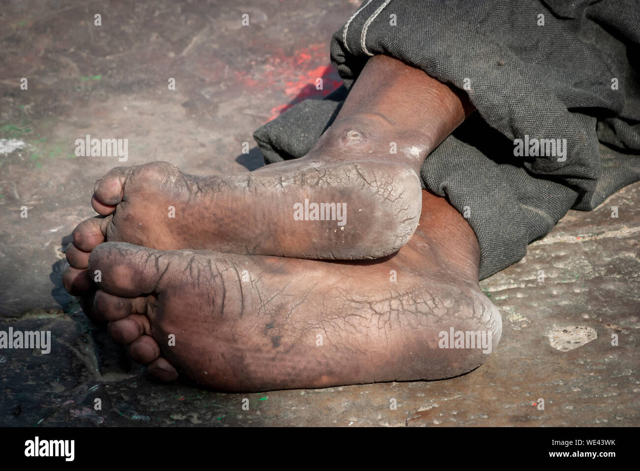 Schmutzige Sohlen der Füße der indischen Mann Stockfoto