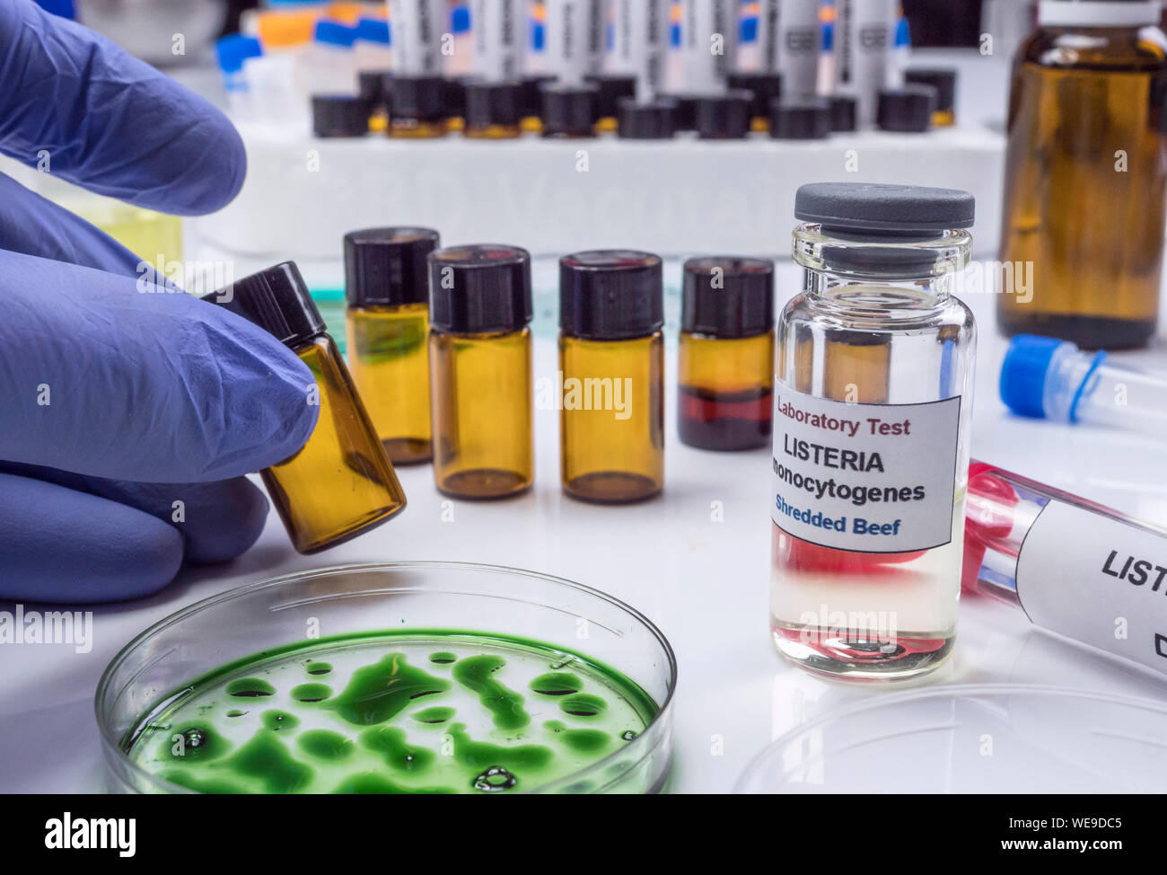 Gutachten gefülltes Fleisch durch Bakterium von Listeria in Labor verseucht, sprießen in Spanien verursacht Stockfoto