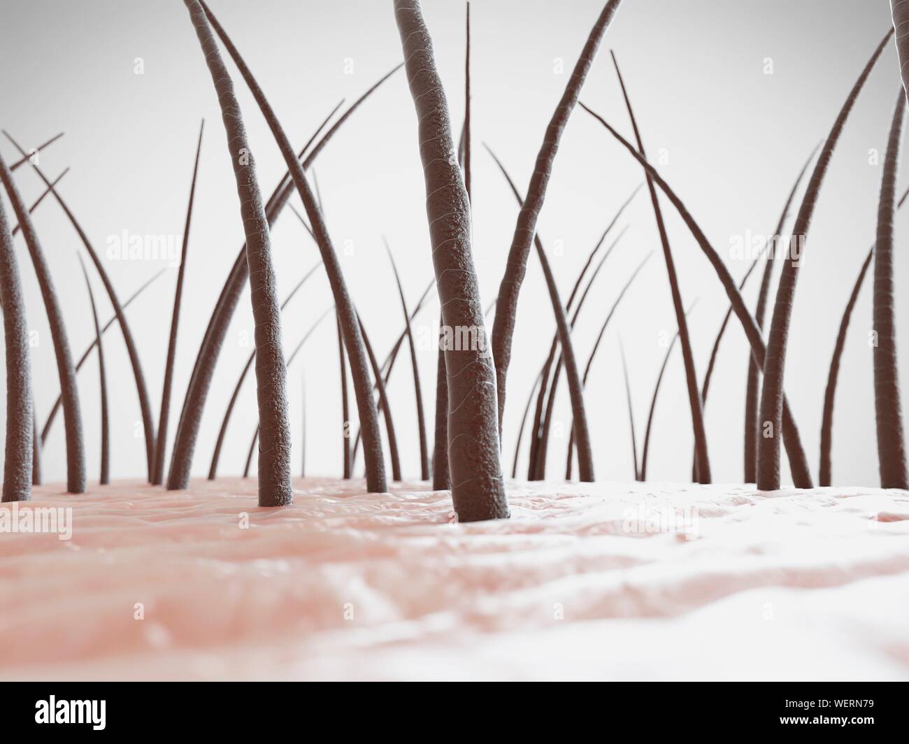 Ungesunde menschliches Haar, Abbildung Stockfoto