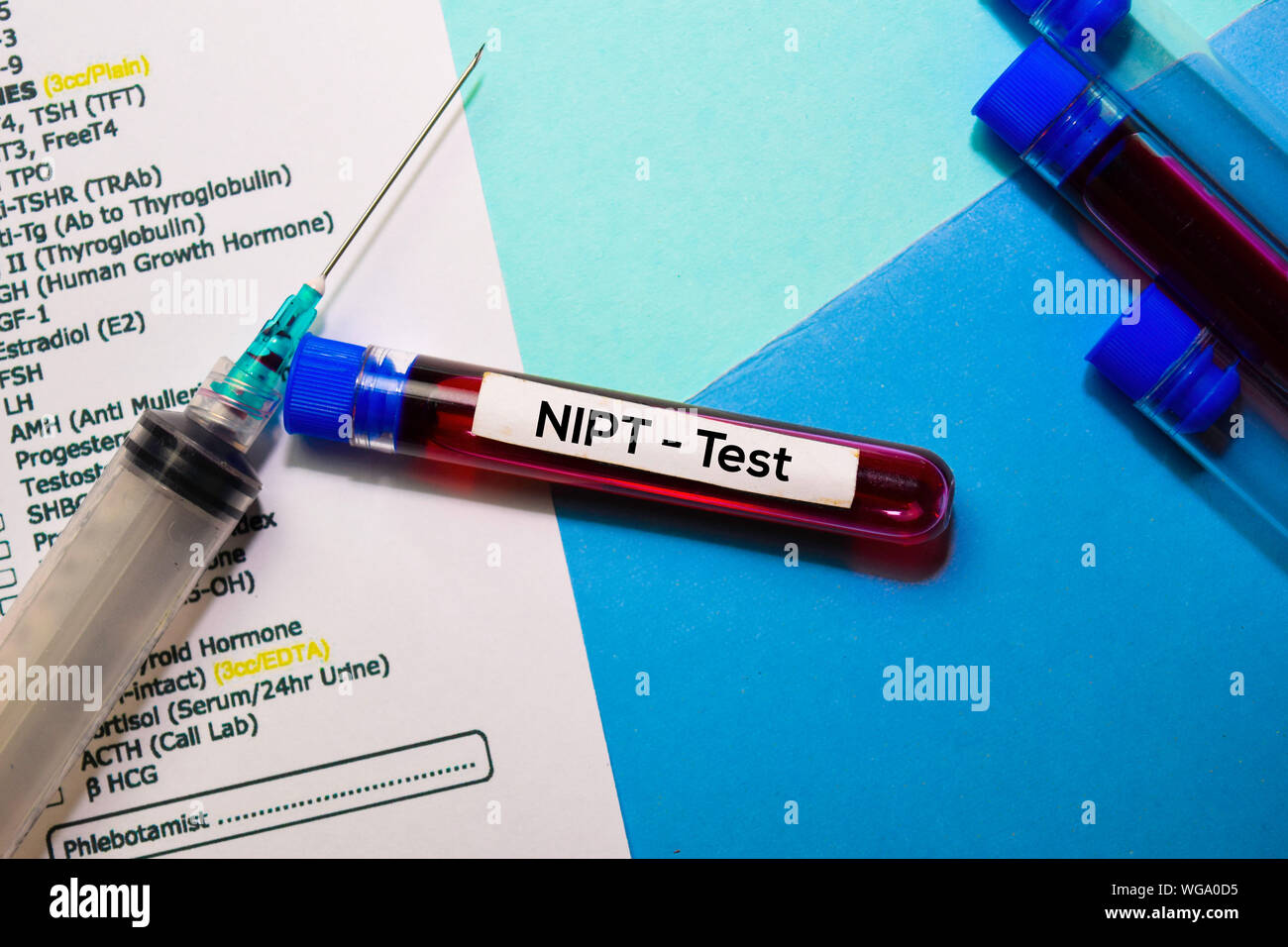 NIPT-Test mit Blutprobe. Draufsicht auf Büro Schreibtisch isoliert. Healthcare/Medical Konzept Stockfoto