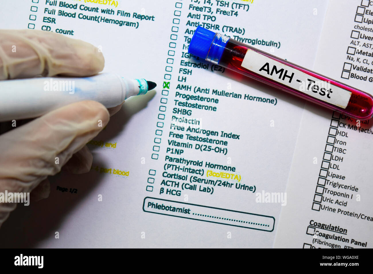 AMH-Test mit Blutprobe. Draufsicht auf Büro Schreibtisch isoliert. Healthcare/Medical Konzept Stockfoto