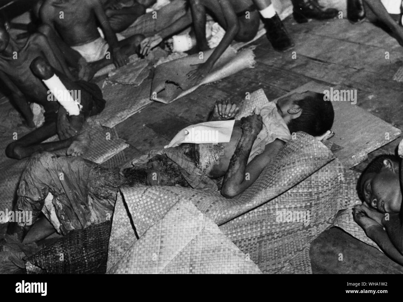 WW2: Japanische Arbeitslager an Seletan. Sick coolie am Punkt des Todes. Singapur. Stockfoto