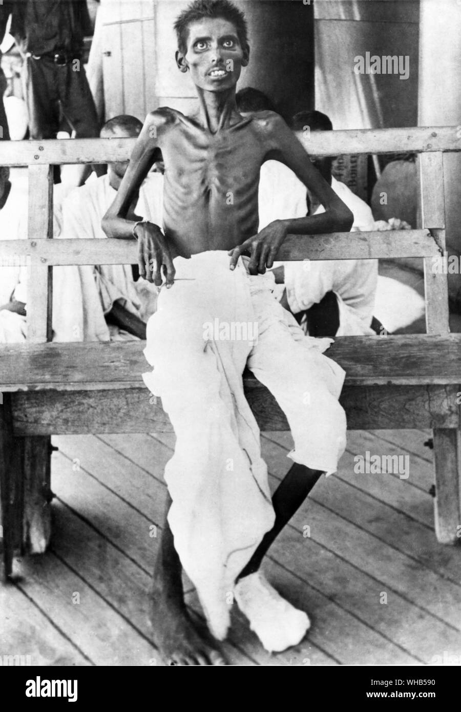 Ein indischer Soldat an Kut gefangen, nachdem Release unter den Austausch von Gefangenen, die Auswirkungen der Unterernährung. Stockfoto