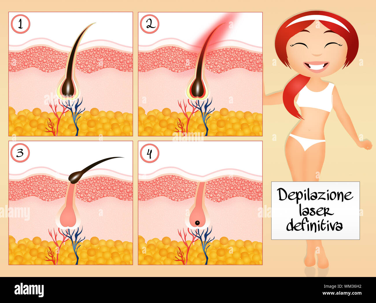 Dauerhafte Haarentfernung Stockfoto