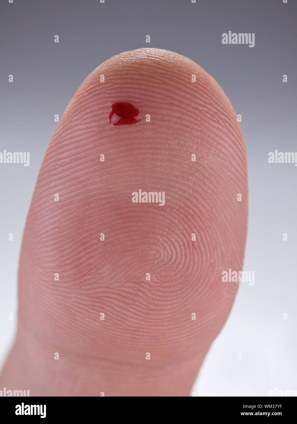 Makro-Ansicht eines Tropfens echtes Blut auf eine menschliche Daumen. Stockfoto